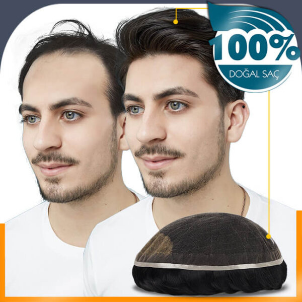 PROTEZ SAÇ SAĞLIĞA ZARARLI MI?