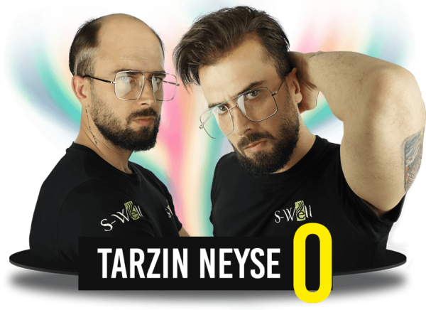 NEDEN SAÇ PROTEZİ?